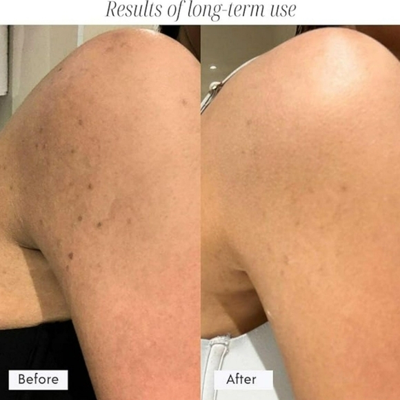 2-in-1 Body Facial PRO - Exfoliator New In Sealed Box - Picture 6 of 6